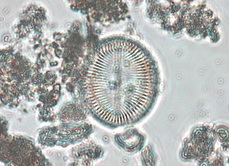 Dictyocha speculum